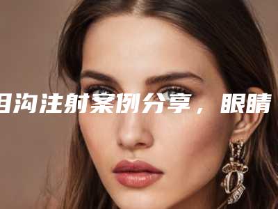 泪沟注射案例分享,眼睛重新变得有神,人也年轻了